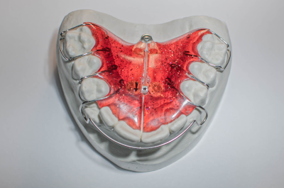 aparat ortodontyczy typu Płytka shwartza