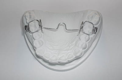 aparat ortodontyczy typu Przerzut podniebienny (TPA)
